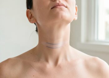 Longitud cervical parto prematuro