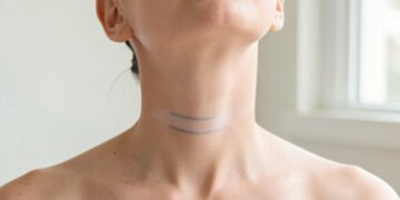 Longitud cervical parto prematuro