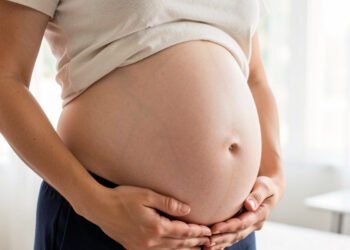 Cambios abdomen postparto